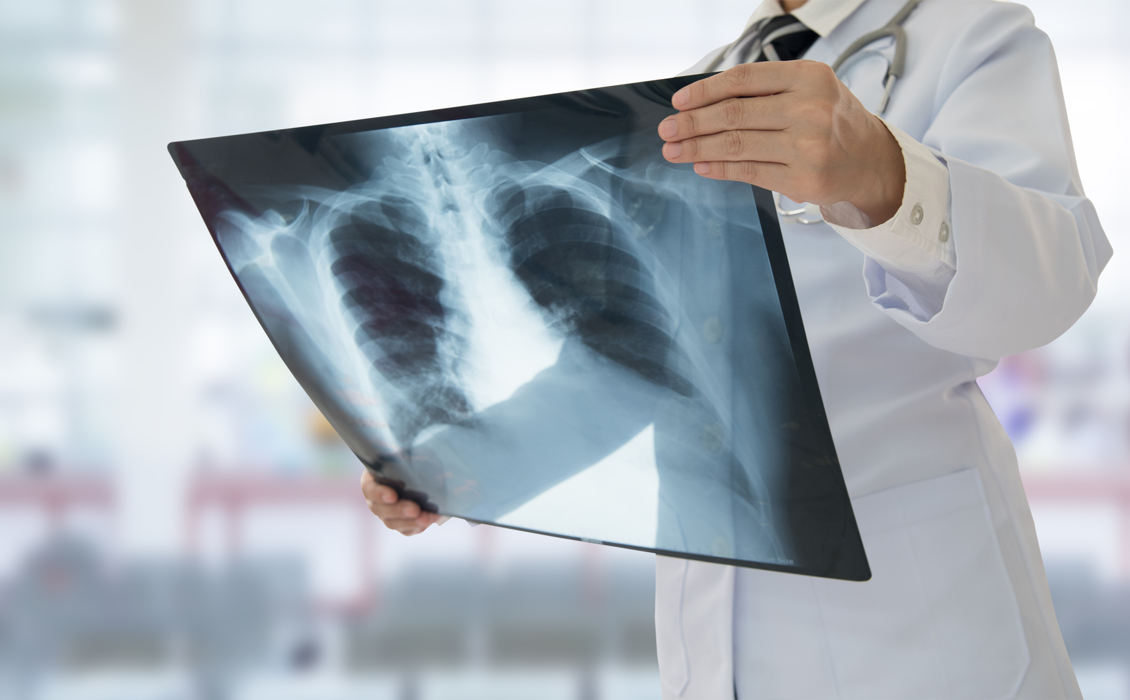 Spinal X-Ray Imaging: Risks vs Benefits