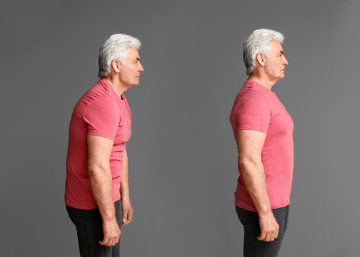 Identifying Poor Posture and Setting It Straight Identifying Poor Posture and Setting It Straight