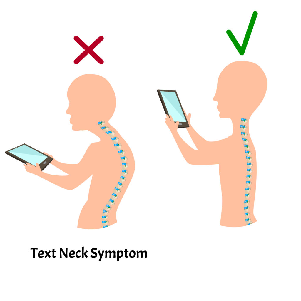 Smartphone Slouching