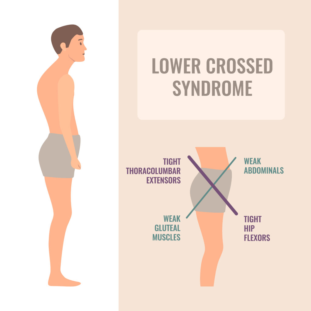 Identifying Poor Posture And Setting It Straight poor posture